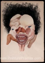 Grossesse extra-utérine